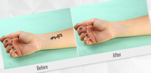 Remove Tattoo in Photoshop